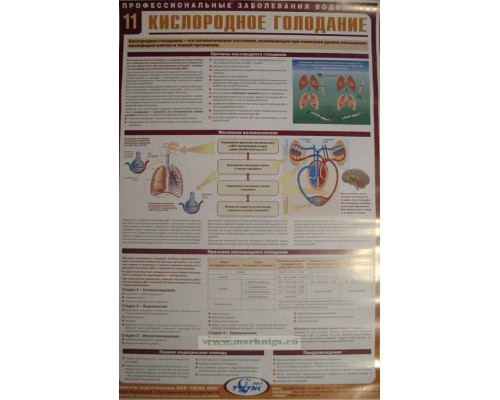 Комплект плакатов (22 шт.) Профессиональные заболевания водолазов