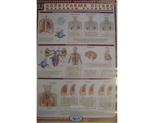 Комплект плакатов (22 шт.) Профессиональные заболевания водолазов