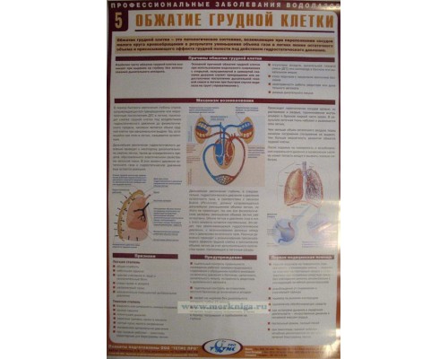 Комплект плакатов (22 шт.) Профессиональные заболевания водолазов