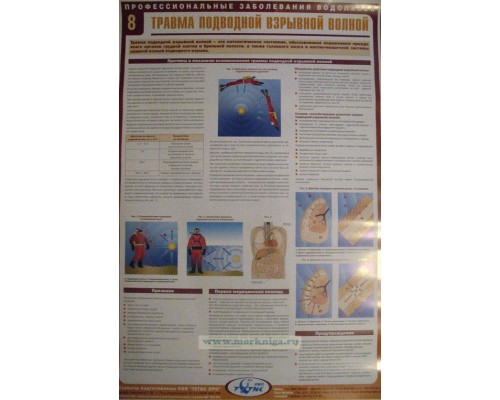 Комплект плакатов (22 шт.) Профессиональные заболевания водолазов